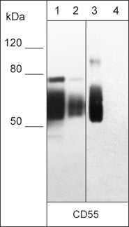 Immunocytochemical labeling of CD55 in paraformaldehyde fixed human MDA-MB-231 breast cancer cells. The cells were labeled with mouse monoclonal anti-CD55 (CM0331). The antibody was detected using goat anti-mouse DyLight® 594.