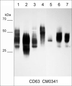 Immunocytochemical labeling of CD63 in paraformaldehyde fixed human MeWo melanoma cells. The cells were labeled with mouse monoclonal CD63 (CM0341). The antibody was detected using goat anti-mouse Ig DyLight® 594.