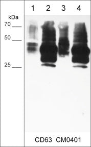 Immunocytochemical labeling of CD63 in paraformaldehyde fixed human MeWo melanoma cells. The cells were labeled with mouse monoclonal CD63 (CM0401). The antibody was detected using goat anti-mouse Ig DyLight® 594.