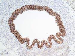 Formalin fixed, citric acid treated parafin sections of embryonic Rat E16 intestines. Sections were probed with anti-E-Cadherin (CM1681) then anti-mouse:HRP before detection using DAB. (Images provided by Carl Hobbs and Dr. Pat Doherty at Wolfson Centre for Age-Related Diseases, King's College London).