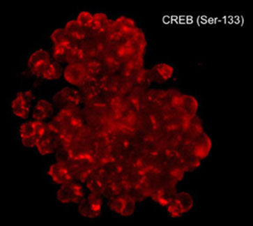 Immunocytochemical labeling of phosphorylated CREB in calyculin A-treated A431 cells. The cells were fixed in paraformaldehyde and permeabilized using NP-40 before labeling with mouse monoclonal CREB (Ser-133). The antibody was detected using goat anti-mouse DyLight® 594.