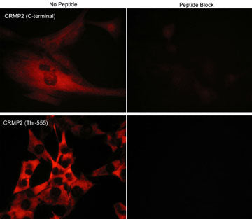 Immunocytochemical labeling of phosphorylated CRMP2 in mouse C2C12 cells. The cells were probed with CRMP2 (C-terminal region) and CRMP2 (Thr-555) rabbit polyclonal antibodies, then the antibodies were detected using appropriate secondary antibodies conjugated to Cy3. The antibodies were used in the absence (left) or presence (right) of their respective blocking peptide (CX2165 or CX2255).