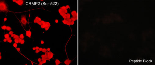 Immunocytochemical labeling of CRMP2 phosphorylation in aldehyde-fixed and NP-40-permeabilized NGF-differentiated PC12 cells. The cells were labeled with rabbit polyclonal anti-CRMP2 (Ser-522) (CP2191) antibody in the absence (Left) or presence (Right) of blocking peptide (CX2195). The antibody was detected using appropriate secondary antibody conjugated to DyLight® 594.