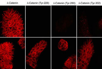 Immunocytochemical labeling of δ1-Catenin in untreated (Top) or pervanadate-treated (bottom) A431 cells. The cells were labeled with mouse monoclonal δ1-Catenin (a.a. 275-285), δ1-Catenin (Tyr-228), δ1-Catenin (Tyr-280), or δ1-Catenin (Tyr-302) antibodies. The antibodies were detected using donkey anti-mouse secondary antibodies conjugated to Cy3.