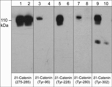 Western blot analysis of δ1-Catenin phosphorylation in A431 cells stimulated with pervanadate (1 mM) for 30 min. (lanes 1,3,5,7,9). The blot was then treated with alkaline phosphatase (lanes 2,4,6,8,10). Blots were probed with anti-δ1-Catenin (a.a. 275-285) (lanes 1 & 2), anti-δ1-Catenin (Tyr-96) (lanes 3 & 4), anti-δ1-Catenin (Tyr-228) (lanes 5 & 6), anti-δ1-Catenin (Tyr-280) (lanes 7 & 8) or anti-δ1-Catenin (Tyr-302) (lanes 9 & 10).