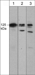 Western blot analysis of DAAM1 expression in mouse C2C12 (lane 1), human A431 (lane 2), and K562 (lane 3) cell lysates. The blots were probed with mouse monoclonal DAAM1 (N-terminal region) antibody at 1:500.