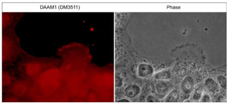 Immunocytochemical labeling of DAAM1 in aldehyde-fixed and NP-40-permeabilized A431 cells. The cells were labeled with mouse monoclonal DAAM1 (N-terminal region) antibody, then the antibody was detected using appropriate secondary antibody conjugated to DyLight® 594. The corresponding phase image is shown to the right.