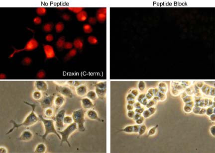 Immunocytochemical labeling of Draxin in rat PC12 cells differentiated with NGF. The cells were probed with Draxin (C-terminal region) rabbit polyclonal antibody, then the antibody was detected using appropriate secondary antibody conjugated to Cy3. The antibody was used in the absence (left) or presence (right) of blocking peptide (DX3675). Lower images show corresponding phase images.