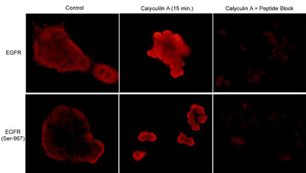 Immunocytochemical labeling in A431 cells untreated or treated with Calyculin A (50 nM) for 15 min. Cells were labeled with anti-EGFR (a.a. 961-972) or anti-EGFR (Ser-967) antibodies. The specificity of labeling was demonstrated for each antibody by blocking the signals with their respective blocking peptides, EGFR (a.a. 961-972) (EX1875) and phospho-EGFR (Ser-967) (EX1915).