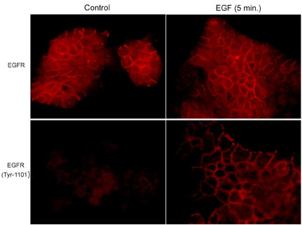 Immunocytochemical labeling in A431 cells untreated or treated with EGF (100 ng/ml) for 5 min. The cells were labeled with mouse monoclonals anti-EGFR (EM1661) and anti-EGFR (Tyr-1101) (EM1991).