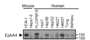 Western blot image of various mouse and human HCC cell lines expressing EphA4 (Cat no EM2801, 1:1000). Image from publication CC-BY-4.0. PMID: 38307859 