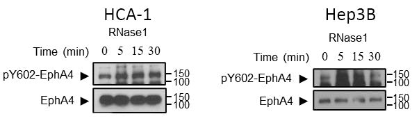 Western blot image of mouse HCA-1 (left) and human Hep3B (right) cells treated with RNase1 (1 ug/ml) at the indicated time points specifically labeling EphA4 (EM2801, 1:1000) and phosphorylated EphA4-Tyr604 (EP2731, 1:1000) Image from publication CC-BY-4.0. PMID: 38307859 