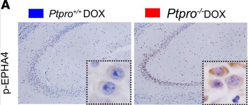 Representative IHC image of p-EPHA4 (cat. EP2731, 1:100) in Ptpro+/+ and Ptpro–/– mice hippocampi. Image from publication CC-BY-4.0. PMID: 37485875