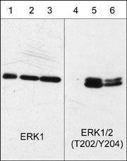 Western blot analysis of human A431 epithelial cells untreated (lanes 1 & 4) or treated with 100 nM calyculin A for 30 min. (lanes 2 & 5) or 100 ng/ml EGF for 60 min. (lanes 3 & 6). The blots were probed with anti-ERK1 (C-terminal region) (lanes 1, 2, & 3) or anti-ERK1/2 (Thr-202/Tyr-204) (lanes 4, 5, & 6).