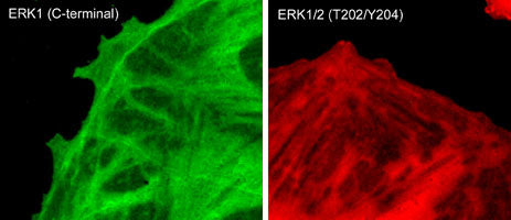 Immunocytochemical labeling of phosphorylated ERK1 in paraformaldehyde-fixed and NP-40-permeabilized rat A7r5 cells treated with calyculin A. The fixed cells were labeled with mouse monoclonal antibodies to anti-ERK1 (EM2331) and anti-ERK1/2 (Thr-202/Tyr-204) (EM2061). The antibodies were detected using Goat anti-Mouse secondary antibodies conjugated to DyLight® 488 (left) and DyLight® 594 (right).