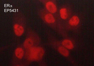 Immunocytochemical labeling of Estrogen Receptor α in paraformaldehyde fixed and NP-40 permeabilized MDA-MB-231 cells. The cells were labeled with rabbit polyclonal anti-Estrogen Receptor α (EP5431). The antibody was detected using goat anti-rabbit DyLight® 594.