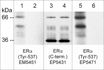 Western blot image of human MCF-7 cells  treated with pervanadate (1 mM) for 30 min. (lanes 1-6). Some lanes of the blot were then treated with alkaline phosphatase (lanes 2, 4, & 6). The blot was probed with mouse monoclonal anti-ERα (Tyr-537) phospho-specific (lanes 1 & 2), rabbit polyclonal anti-ERα (C-terminus) (lanes 3 & 4), and rabbit polyclonal anti-ERα (Tyr-537) phospho-specific (lanes 5 & 6).