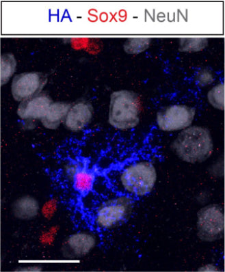 Representative image of astrocyte transduced with AAV, labeled with HA (cat. ET-HA100; blue) and astrocytemarker (Sox9). Neurons are identified by NeuN staining. Image from publication CC-BY-4.0. PMID:38574730