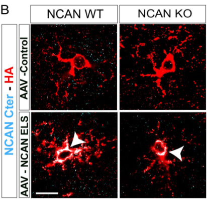 Representative images of astrocytes transduced with AAV Control-HA or AAV NCAN ELS-HA (marked with HA (cat. ET-HA100) in red) and NCAN C-terminal in cyan. Image from publication CC-BY-4.0. PMID:38574730