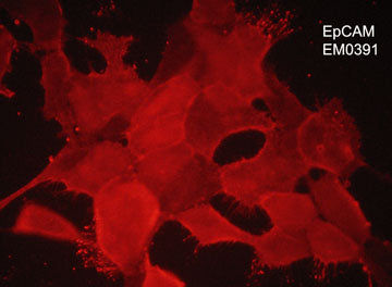 Immunocytochemical labeling of EpCAM in aldehyde fixed human NCI-H1915 lung carcinoma cells. The cells were labeled with mouse monoclonal anti-EpCAM (EM0391). The antibody was detected using goat anti-mouse Ig:DyLight® 594.