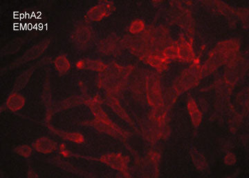 Immunocytochemical labeling of EphA2 in aldehyde fixed human MDA-MB-231 breast carcinoma cells. The cells were labeled with mouse monoclonal anti-EphA2 (EM0491). The antibody was detected using goat anti-mouse DyLight® 594.