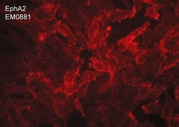 Immunocytochemical labeling of EphA2 in aldehyde fixed human MDA-MB-231 breast carcinoma cells. The cells were labeled with mouse monoclonal anti-EphA2 (EM0881). The antibody was detected using goat anti-mouse DyLight® 594.