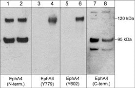 Western blot analysis of human umbilical vein endothelial cells untreated (lanes 1, 3, 5, & 7) or treated with pervanadate (1 mM) for 30 min. (lanes 2, 4, 6, & 8). The blot was probed with anti-EphA4 (N-terminal region) (lanes 1 & 2), anti-EphA4 (Tyr-779) (lanes 3 & 4), anti-EphA4 (Tyr-602) (lanes 5 & 6), or anti-EphA4 (C-terminal region) (lanes 7 & 8).