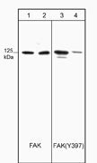 Western blot analysis of HUVECs untreated (lanes 1 & 3) or treated with alkaline phosphatase (lanes 2 & 4). Blots were probed with mouse monoclonal anti-FAK (lanes 1 & 2) and anti-FAK (Tyr-397) (lanes 3 & 4).