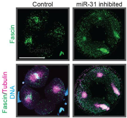 Sea urchin embryos were injected with control miR-124 LNA inhibitor or miR-31 LNA inhibitor and immunolabeled with Fascin antibody (cat. FM2651, green) and tubulin antibody (magenta) followed by DAPI counterstain for DNA (blue). Image from publication CC-BY-4.0. PMID: 37398341