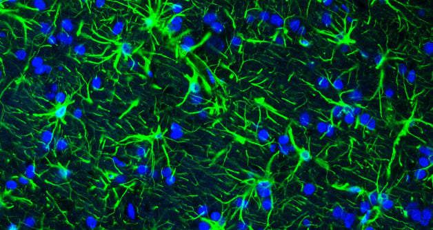 Representative section of formalin fixed, paraffin-embedded rat brain showing staining of GFAP. The sections were stained with Aves Labs anti-GFAP antibody (visualized in green) (Cat. No. GFAP) at 1:500 dilution. The stained sections were mounted with Antibodies Incorporated FluoroshieldTM with DAPI and DABCO mounting medium (Cat No. AR-6505). DAPI nuclear stain (blue) shows cell nuclei. Anti-GFAP specifically stains the astrocytes in the rat brain.