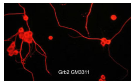 Immunocytochemical labeling of Grb2 in rat PC12 cells differentiated with NGF. The cells were labeled with mouse monoclonal Grb2 (GM3311) antibody, then detected using appropriate secondary antibody conjugated to Cy3.