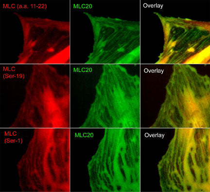 Immunocytochemical labeling of phosphorylated MLC in paraformaldehyde fixed A7r5 cells. The cells were dual-labeled with anti-MLC (MM3441; middle) and anti-MLC (MP4201; top left), anti-MLC (Ser-19) (MP4221; middle left) and anti-MLC (Ser-1) (MP3461; bottom left). Goat anti-Mouse DyLight® 488 and Goat anti-Rabbit DyLight® 594 were used for detection of primary antibodies. The overlay of staining patterns are shown to the right.