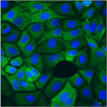 Immunofluorescent staining of MCF7 cells using 10 ug/mL mouse monoclonal anti-Cytokeratin-19 (CK19) antibody (MM-1002) (green). The cells were mounted with Antibodies Incorporated Fluoroshield with DAPI mounting medium (Cat