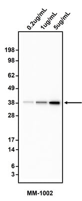Western blotting of HepG2 cell lysate using 0.2 ug/mL, 1 ug/mL, or 5 ug/mL mouse anti-Cytokeratin-19 antibody (MM-1002). MM-1002 mouse anti-CK19 antibody recognizes endogenous CK19 at ~40 kDa.