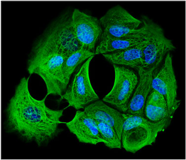 Immunofluorescent staining of MCF7 cells using 1 ug/mL mouse monoclonal anti-Cytokeratin-cocktail antibody (MM-1012) (green). The cells were mounted with Antibodies Incorporated Fluoroshield with DAPI mounting medium (Cat