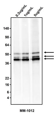 Western blotting of HepG2 cell lysate using  0.2 ug/mL, 1 ug/mL, or 5 ug/mL mouse anti-Cytokeratin cocktail antibody (MM-1012).