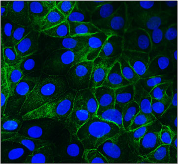 Immunofluorescent staining of MCF7 cells using 10 ug/mL mouse monoclonal anti-EpCAM antibody (MM-1014) (green). The cells were mounted with Antibodies Incorporated Fluoroshield with DAPI mounting medium (Cat