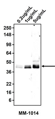 Western blotting of SW1116 cell lysate using 0.2 ug/mL, 1 ug/mL, or 5 ug/mL mouse monoclonal anti-Epithelial Specific Antigen (Ep-CAM) antibody (MM-1014). MM-1014 mouse anti-Ep-CAM antibody recognizes endogenous Ep-CAM at 40 kDa.