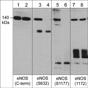 Western blot analysis of human umbilical vein endothelial cells treated with calyculin A (100 nM) for 30 min. (lanes 1, 3, 5 & 7) then the blots were treated with lambda phosphatase (lanes 2, 4, 6 & 8). The blots were probed with anti-endothelial nitric oxide synthase (eNOS) (C-terminal region) (lanes 1 & 2), anti-eNOS (Ser-632) (lanes 3 & 4), anti-eNOS (Ser-1177) (lanes 5 & 6) and anti-eNOS (a.a. 1172-1181) (lanes 7 & 8).