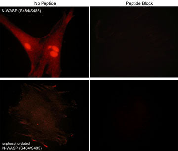 Immunocytochemical labeling of phospho- and unphospho-N-WASP in rabbit spleen fibroblasts. The cells were probed with N-WASP (Ser-484/Ser-485) phospho-specific and N-WASP (Ser-484/Ser-485) unphosphorylated antibodies, then the antibodies were detected using appropriate secondary antibodies conjugated to Cy3. The antibodies were used in the absence (left) or presence (right) of blocking peptide (WX2205 or WX2405).