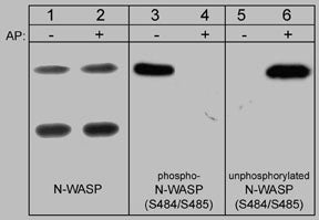 Western blot of control and alkaline phosphatase-treated (AP) neonatal rat brain lysate (20 µg/lane). Blots were probed with anti-N-WASP (Lanes 1 & 2), anti-phospho-N-WASP (S484/S485) (Lanes 3 & 4), or anti-unphosphorylated-N-WASP (S484/S485) (Lanes 5 & 6).