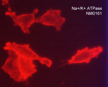 Immunocytochemical labeling of Na+/K+ ATPase β3 in paraformaldehyde fixed human MDA-MB-231 cells. The cells were labeled with mouse monoclonal anti-Na+/K+ ATPase β3 (clone M016). The antibody was detected using goat anti-mouse Ig DyLight® 594.