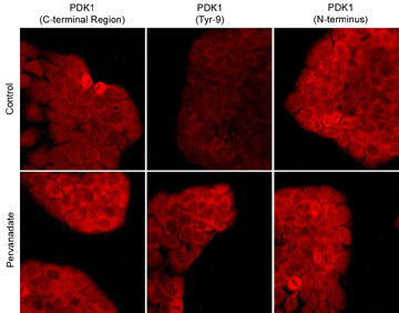 Immunocytochemical labeling of PDK1 phosphorylation in control and pervanadate-treated A431 cells. The cells were labeled with mouse monoclonal PDK1 (C-terminal Region) (PM1461), rabbit polyclonal PDK1 (Tyr-9) (PP1431), and PDK1 (N-terminus) (PP1411) antibodies. These antibodies were detected using appropriate secondary antibody conjugated to DyLight® 594.