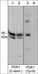 Western blot image of A431 cells stimulated with pervanadate (lanes 1 and 3). The blots were then treated with akaline phosphatase (lanes 2 & 4) then probed with anti-PDK1 (C-terminal region) mouse monoclonal antibody or anti-PDK1 (Tyr-9) (PP1431) rabbit polyclonal antibody.