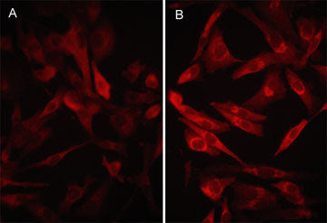 Immunocytochemical labeling of PD-L1 in aldehyde fixed human MDA-MB-231 carcinoma cells untreated (A) or treated with 100 ng/ml IFNγ for 48 hrs (B). The cells were labeled with mouse monoclonal anti-PD-L1 (PM0511). The antibody was detected using goat anti-mouse DyLight® 594.