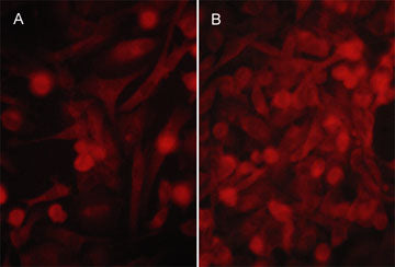 Immunocytochemical labeling of PD-L1 in aldehyde fixed human MDA-MB-231 carcinoma cells untreated (A) or treated with 100 ng/ml IFNγ for 48 hrs (B). The cells were labeled with mouse monoclonal anti-PD-L1 (PM0801). The antibody was detected using goat anti-mouse DyLight® 594.