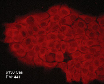 Immunocytochemical labeling of p130 Cas in aldehyde fixed human A431 epidermoid carcinoma cells. The cells were labeled with mouse monoclonal anti-p130 Cas (PM1441). The antibody was detected using goat anti-mouse DyLight® 594.