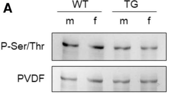 Western blot showing N2B-Titin total phosphorylation (cat. PP2551, 1:500) in male and female mRen2 and WT rats. Image from publication CC-BY-4.0. PMID: 37363100