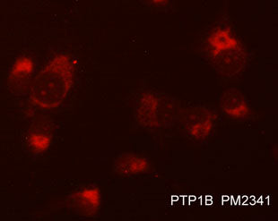 Immunocytochemical labeling of PTP1B in methanol and acetone fixed human NCI-H1915 lung carcinoma cells. The cells were labeled with mouse monclonal anti-PTP1B (PM2341) antibody. The antibody was detected using appropriate secondary antibody conjugated to DyLight® 594.