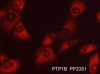 Immunocytochemical labeling of PTP1B in aldehyde-fixed and NP-40 permeabilized human NCI-H1915 lung carcinoma cells. The cells were labeled with rabbit polyclonal anti-PTP1B (PP2351) antibody. The antibody was detected using appropriate secondary antibody
conjugated to DyLight® 594.